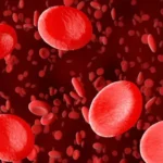 Segni di anemia: attenzione a questi sintomi comuni e spesso trascurati