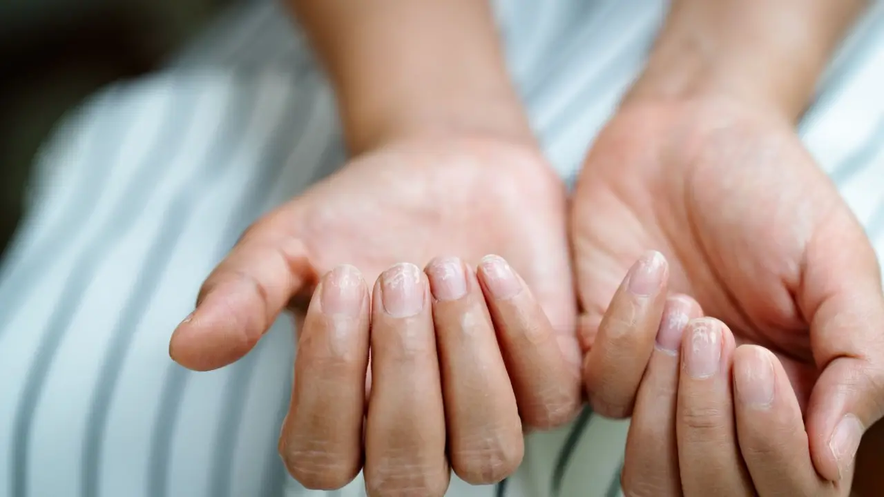 Come si fa a smettere di mangiarsi le unghie? Il trucco psicologico che ti aiuta a perdere il vizio